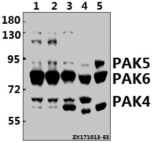 a01723 1 pak4 primary antiboties wb testing 1