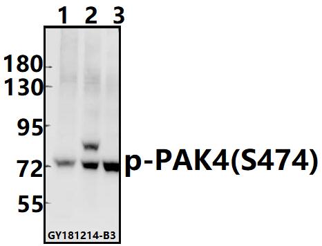 Western blot (WB) analysis of p-PAK4/5/6 (S474) pAb at 1:500 dilution
Lane1:PC3 whole cell lysate(40ug)
Lane2:HCT116 whole cell lysate(40ug)
Lane3:MCF-7 whole cell lysate(40ug)
