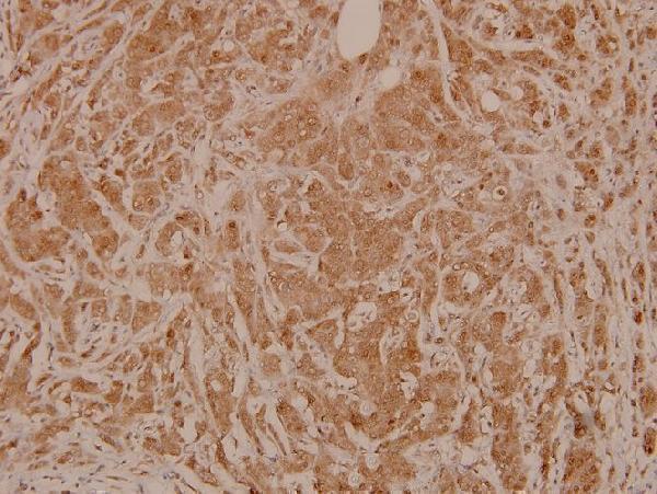 a01725s80 map2k4 primary antiboties ihc testing 2