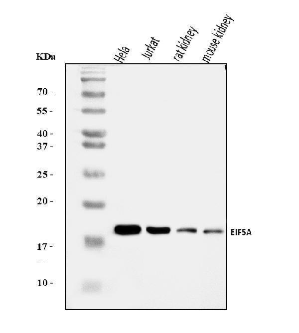  Western blot analysis of EIF5A using anti-EIF5A antibody (A01727-3)