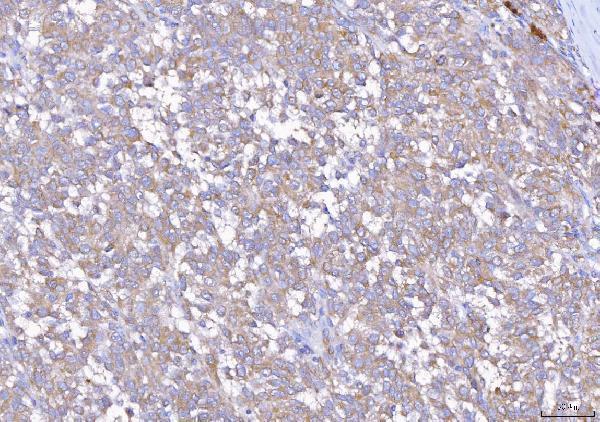  IHC analysis of EIF5A using anti-EIF5A antibody (A01727-4)