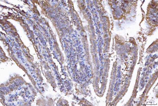 a01727 4 eif5a primary antibodies ihc testing 4