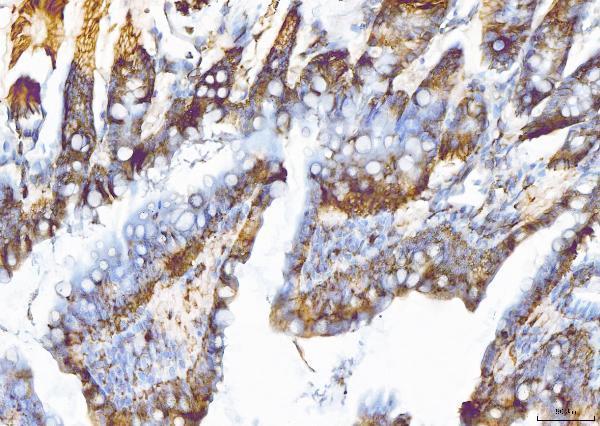 a01727 4 eif5a primary antibodies ihc testing 5