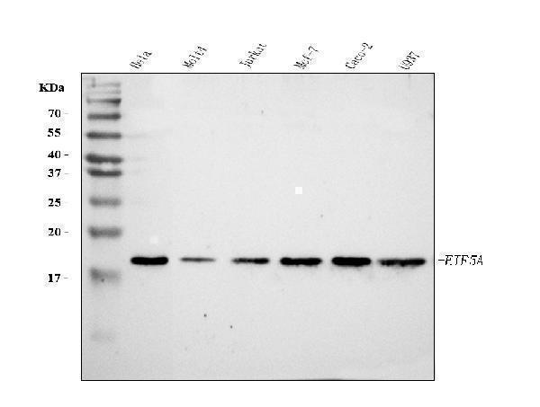  Western blot analysis of EIF5A using anti-EIF5A antibody (A01727-4)