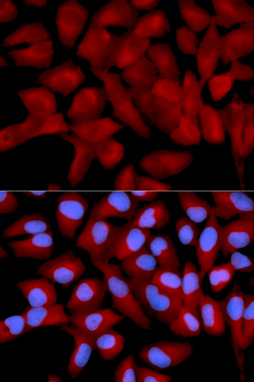 Immunofluorescence analysis of U2OS cells using eIF5A antibody 