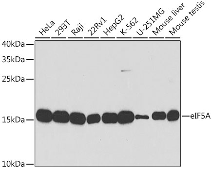 Western blot analysis of extracts of various cell lines, using eIF5A antibody  at 1:1000 dilution