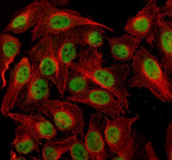 a01729 2 hcfc1 primary antibodies if testing 1