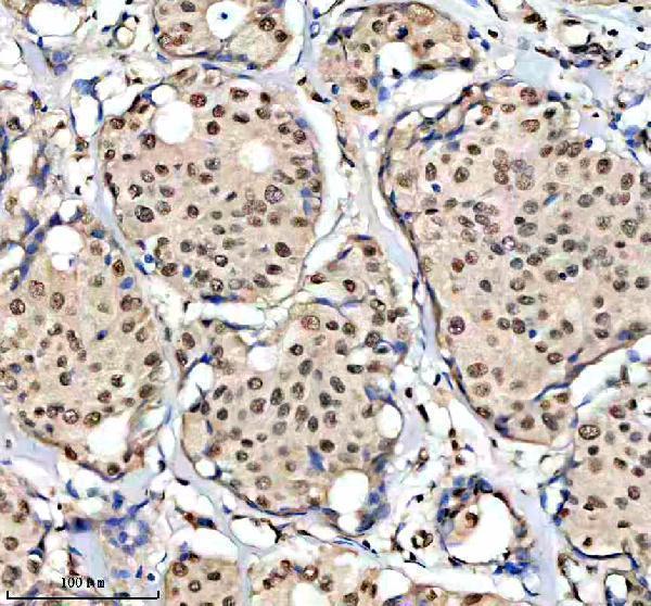 IHC analysis of HCFC1 using anti-HCFC1 antibody (A01729-2)