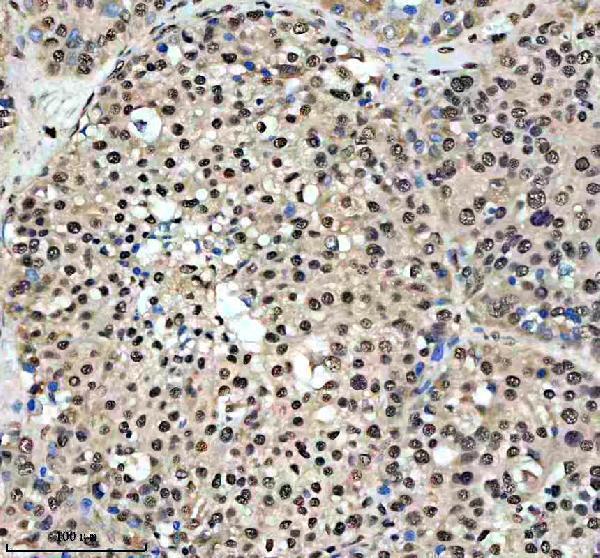IHC analysis of HCFC1 using anti-HCFC1 antibody (A01729-2)