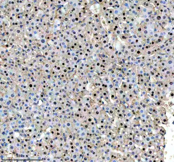 a01729 2 hcfc1 primary antibodies ihc testing 3