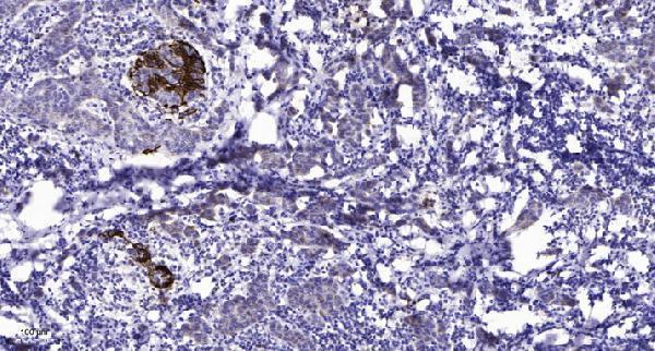 a01730 rfc1 primary antibodies ihc testing 1