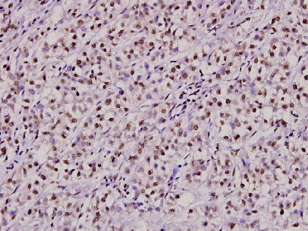 a01732s1 xrcc6 primary antiboties ihc testing 2