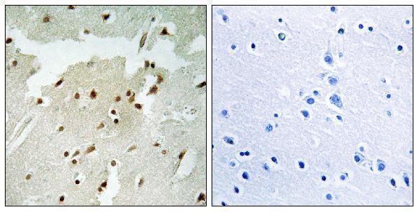a01732s5 1 xrcc6 primary antibodies ihc testing 1