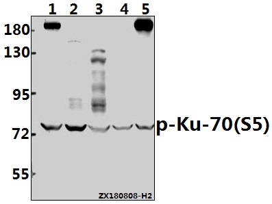 a01732s5 xrcc6 primary antiboties wb testing 1