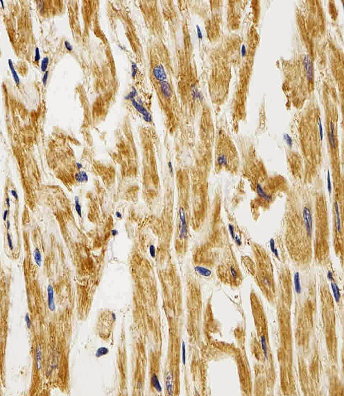 Immunohistochemical analysis of paraffin-embedded H