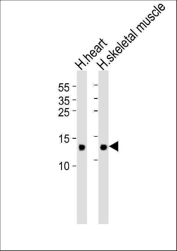Western blot analysis of lysates from human heart and skeletal muscle tissue lysate (from left to right), using FABP3 Antibody