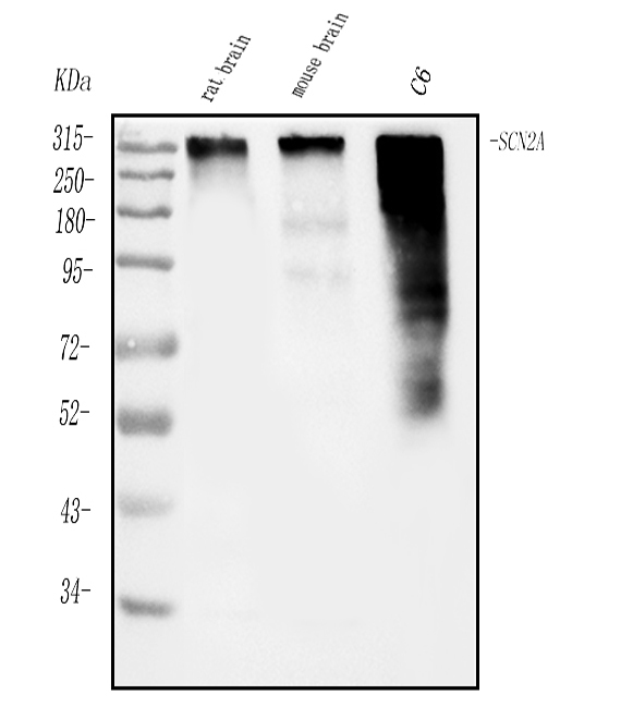 a01735 2 scn2a primary antibodies wb testing 1