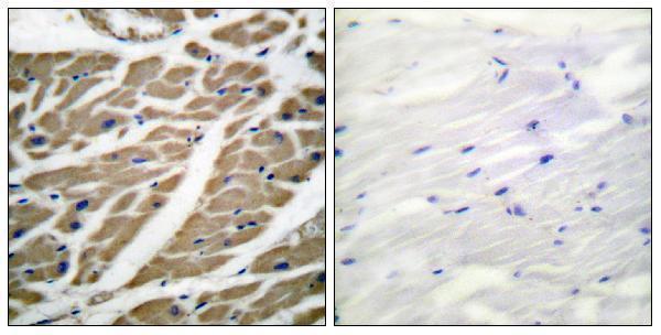 a01735 scn1a primary antibodies ihc testing 1