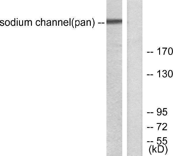 a01735 scn1a primary antibodies wb testing 3
