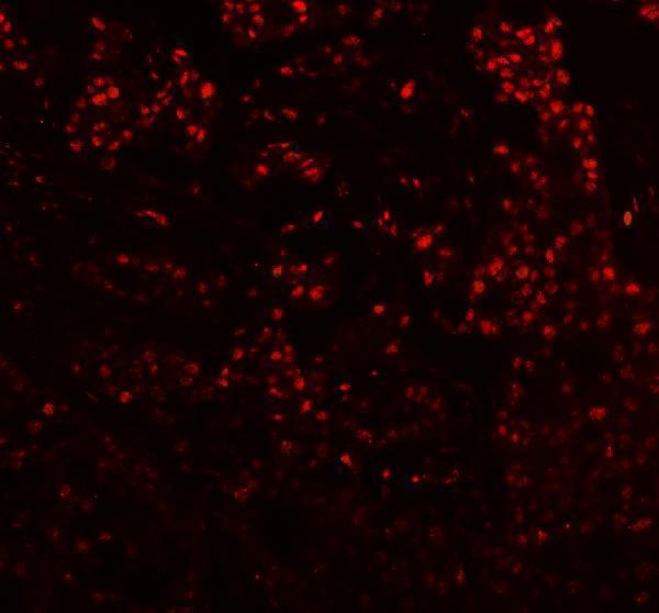 a01736 1 dis3 primary antibodies if testing 1
