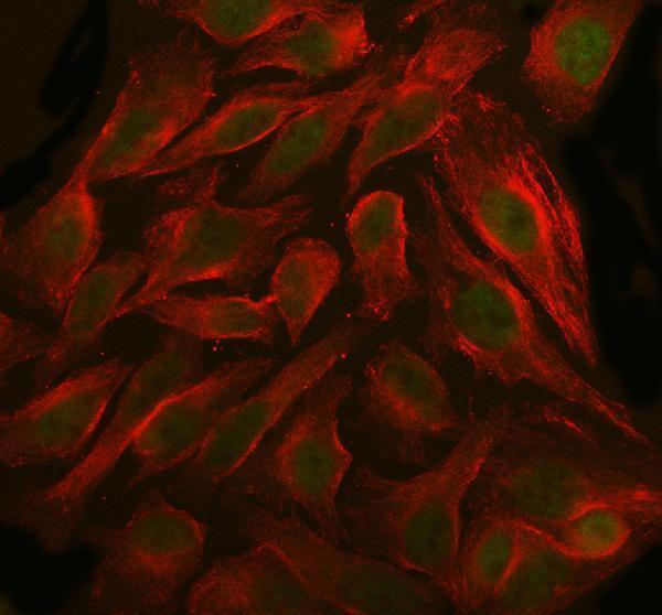 a01736 2 dis3 primary antibodies if testing 10
