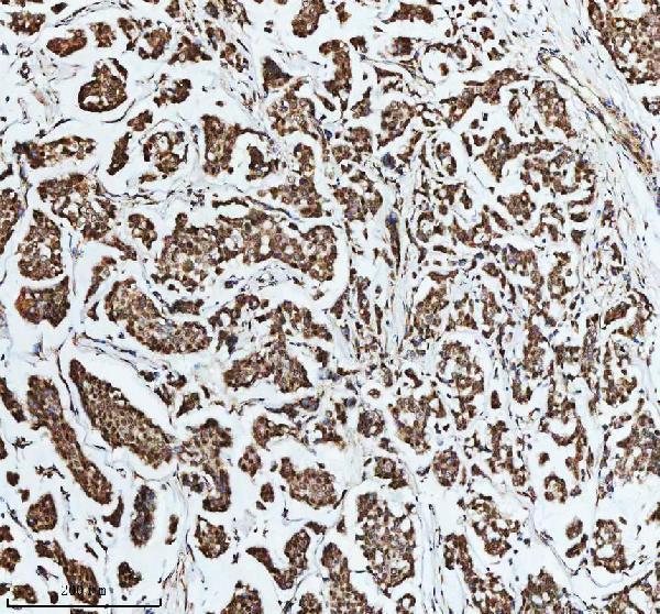 IHC analysis of DIS3 using anti-DIS3 antibody (A01736-2)