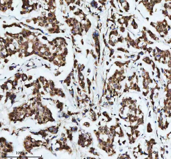  IHC analysis of DIS3 using anti-DIS3 antibody (A01736-2)