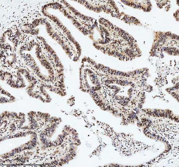 a01736 2 dis3 primary antibodies ihc testing 4