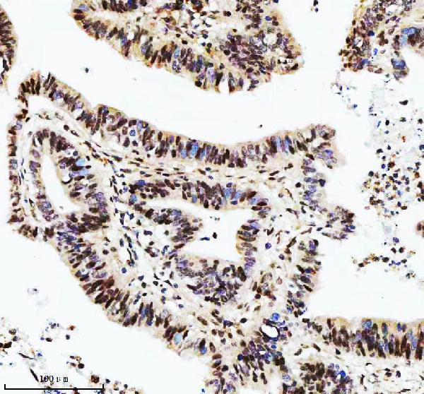 a01736 2 dis3 primary antibodies ihc testing 5