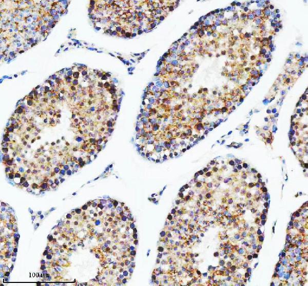 a01736 2 dis3 primary antibodies ihc testing 7