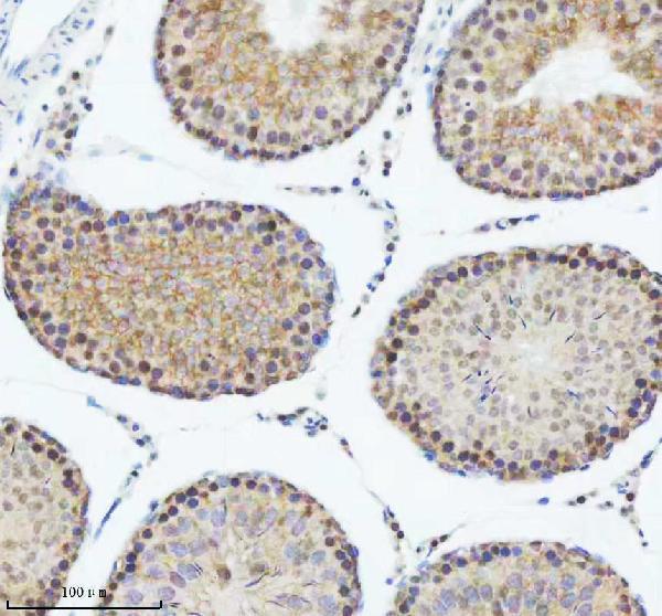a01736 2 dis3 primary antibodies ihc testing 9