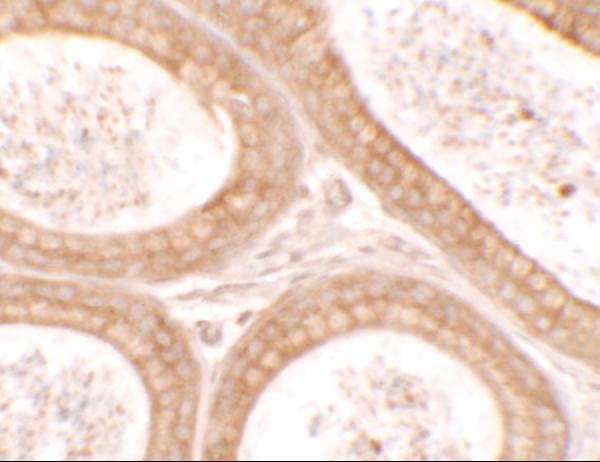 a01736 dis3 primary antibodies ihc testing 2