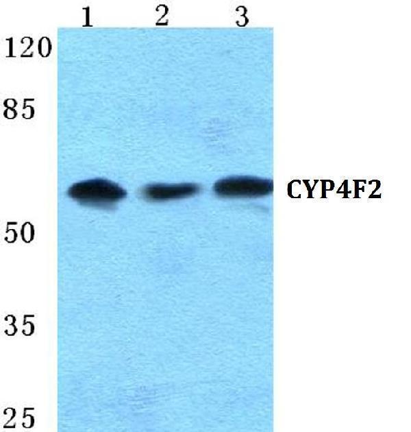 Western blot (WB) analysis of CYP4F2 polyclonal antibody at 1:500 dilution
Lane1:Hela cell lysate
Lane2:NIH-3T3 cell lysate
Lane3:PC12 cell lysate