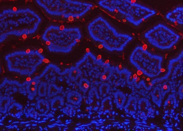 a01738 3 tff3 primary antibodies if testing 4