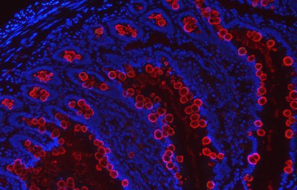 a01738 3 tff3 primary antibodies if testing 5