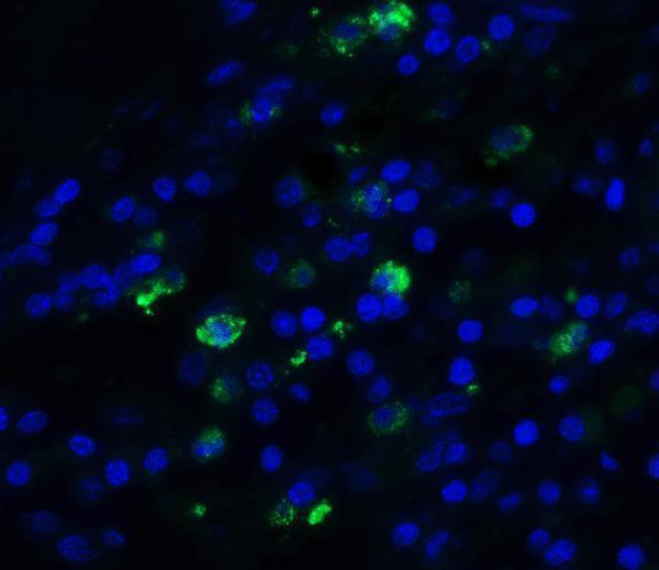 a01738 tff3 primary antibodies if testing 5