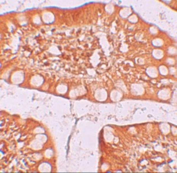 Immunohistochemistry of TFF3 in human small intestine tissue with TFF3 antibody at 2