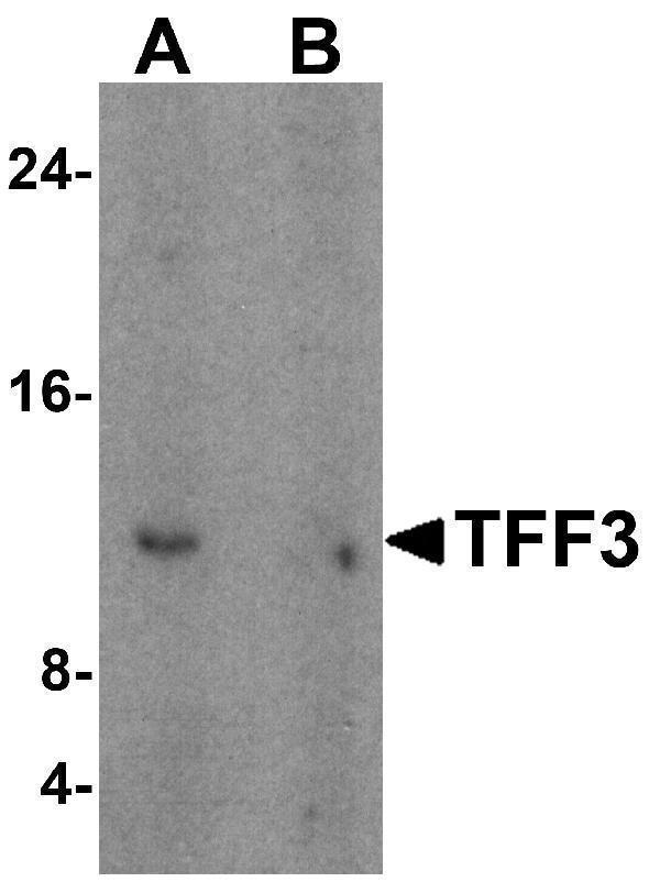 Western blot analysis of TFF3 in human colon tissue lysate with TFF3 antibody at 1 μg/mL in (A) the absence and (B) the presence of blocking peptide