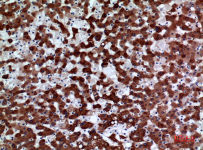 Immunohistochemical analysis of paraffin-embedded human-liver, antibody was diluted at 1:100