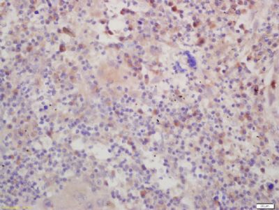 a01740 dspp primary antiboties ihc testing 3