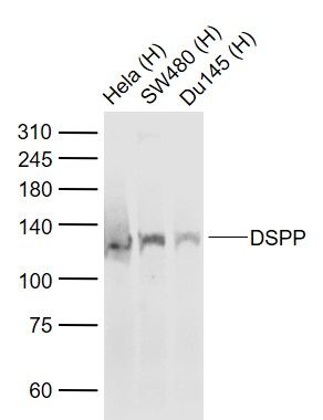 a01740 dspp primary antiboties wb testing 1