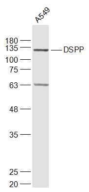 a01740 dspp primary antiboties wb testing 2
