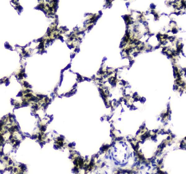 a01741 1 ces1 primary antibodies ihc testing 5