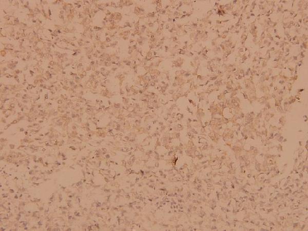 a01743 ppp1r12a primary antiboties ihc testing 2