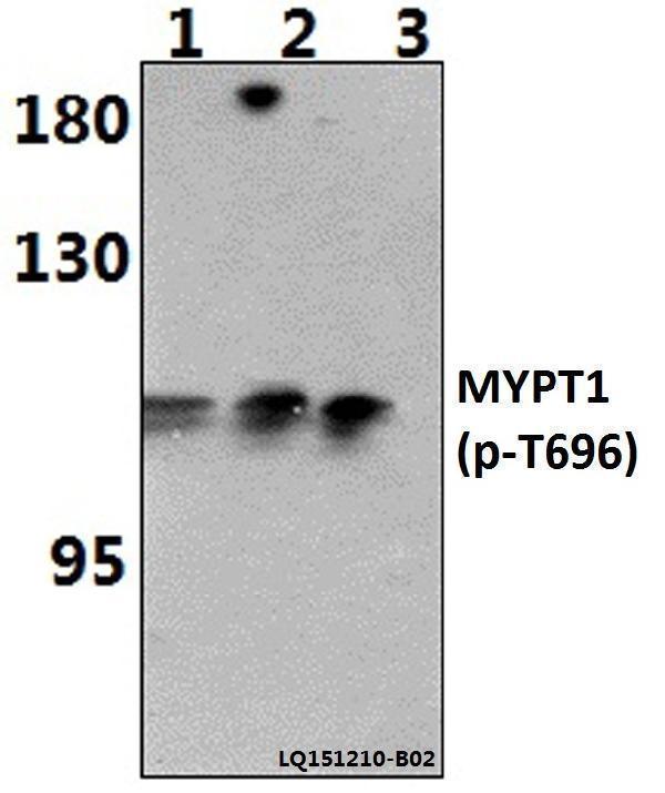 a01743t696 ppp1r12a primary antiboties wb testing 1