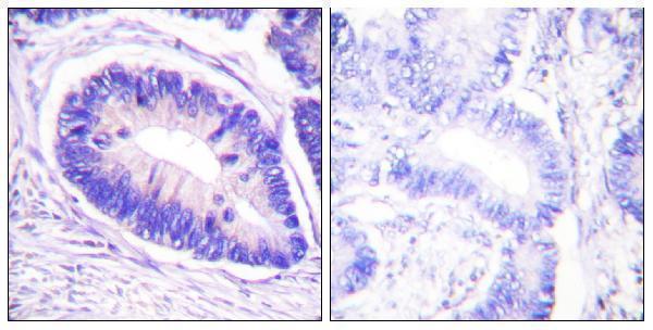a01743t853 1 ppp1r12a primary antibodies ihc testing 4