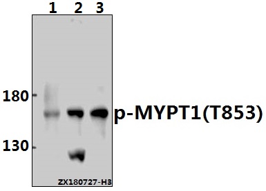 a01743t853 ppp1r12a primary antiboties wb testing 1
