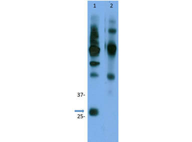 Immunoprecipitation of Rabbit Anti-Cyclin D3