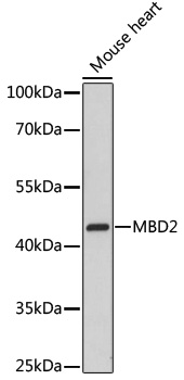 Western blot analysis of extracts of mouse heart, using MBD2 antibody  at 1:3000 dilution