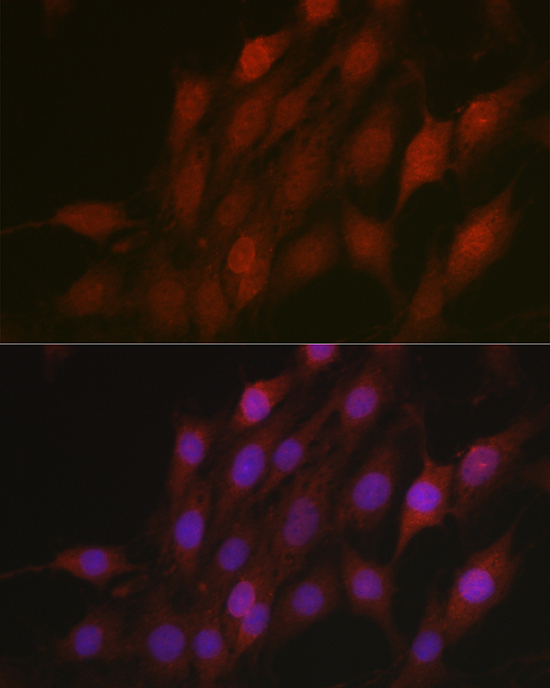 Immunofluorescence analysis of C6 cells using β-TrCP/BTRC Rabbit pAb  at dilution of 1:100 